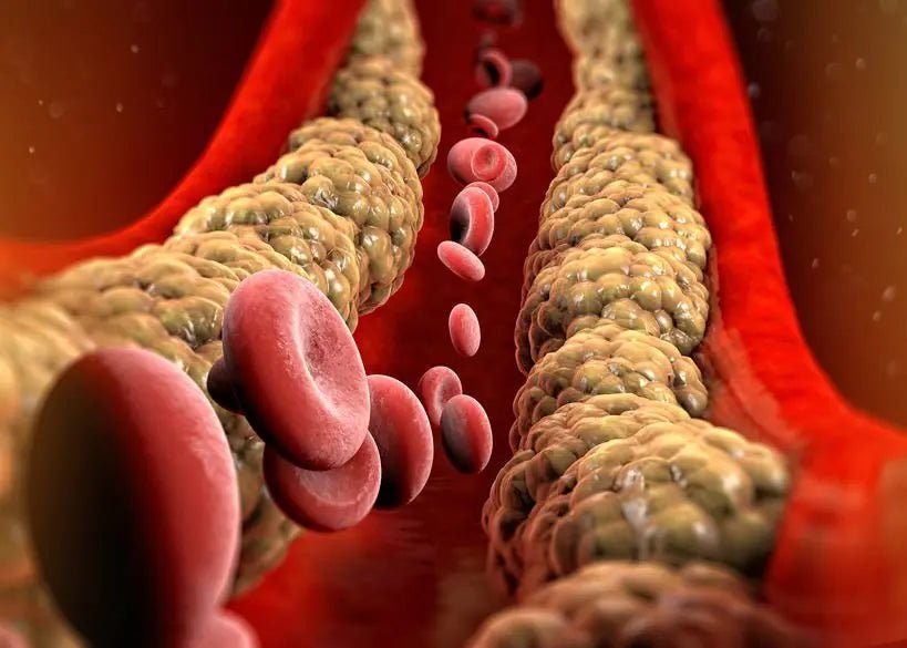 Scopriamo il colesterolo: definizione e rimedi - Prodotti Herbalife Online